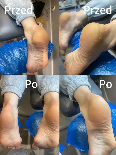 Podolux - gabinet podologiczny i pielęgnacja stóp